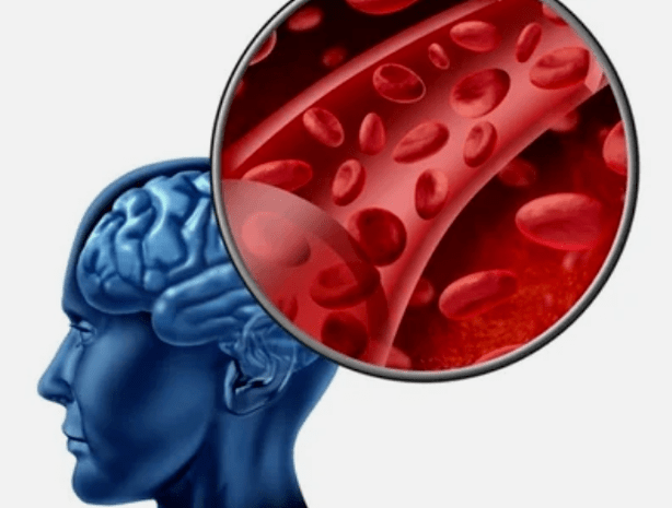 Osteocondrosis del cuello
