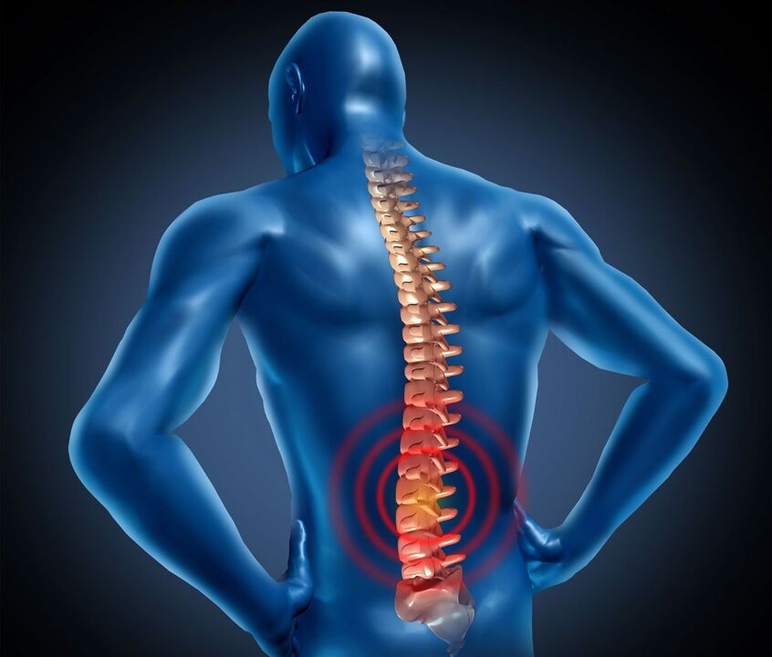 Osteocondrosis lumbar