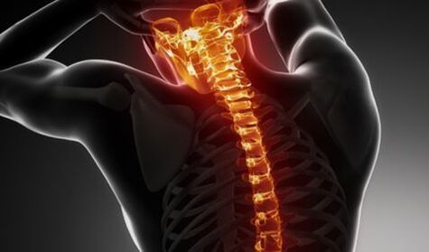 Osteocondrosis de toda la columna vertebral