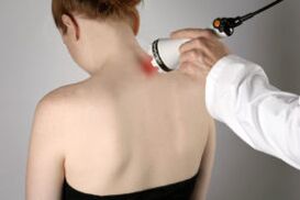 Tratamiento de la osteocondosis cervical con terapia con láser