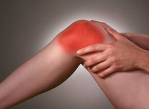 El síntoma de la osteoartritis es un dolor severo en el área de la rodilla