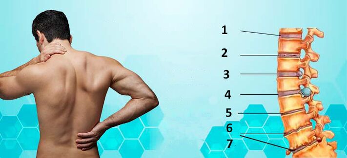 etapas de desarrollo de la osteocondrosis